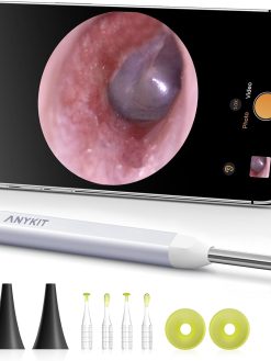 Anykit Visual Ear Wax Removal Camera, Type-C Digital Otoscope with 6 LED Lights and Ear Camera with Earwax Removal Tool for Adults & Children, Compatible with iPhone 15& Android (White)